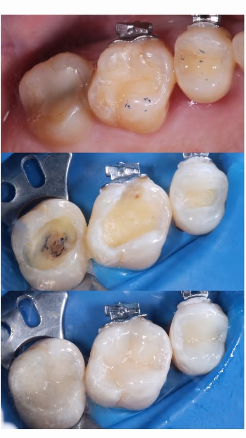 До и после — случай 5