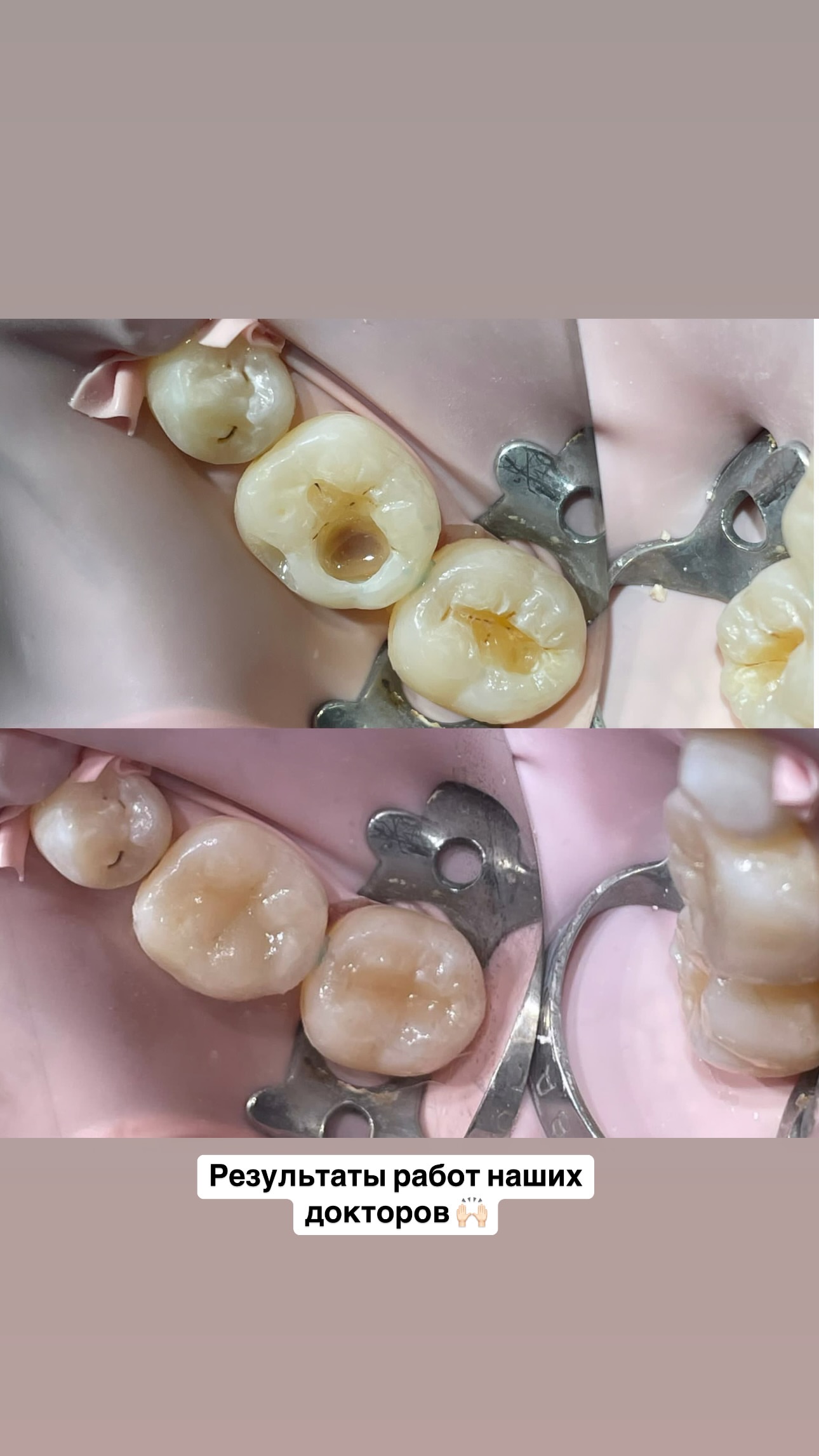 Профессиональная чистка