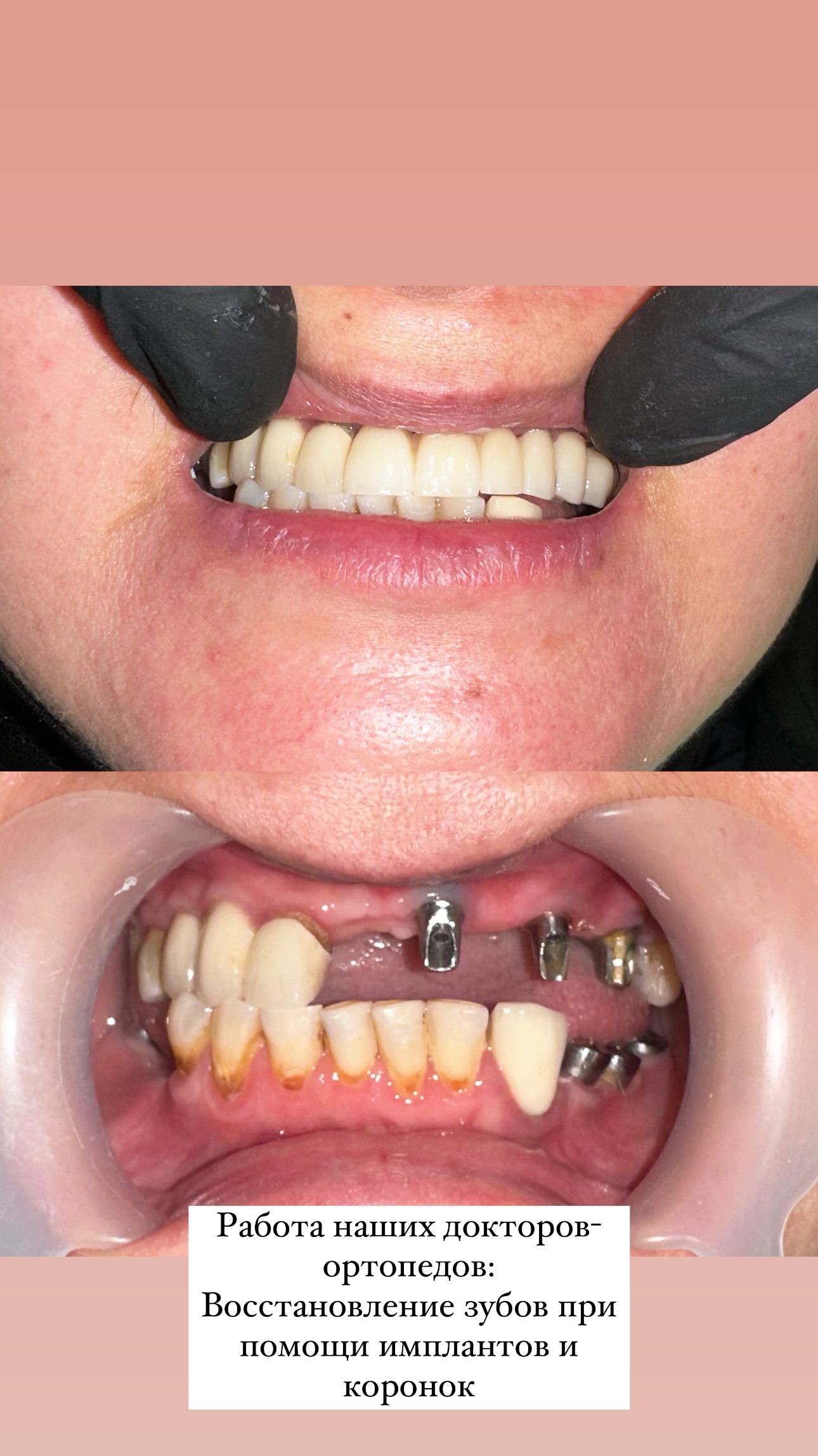 До и после лечения