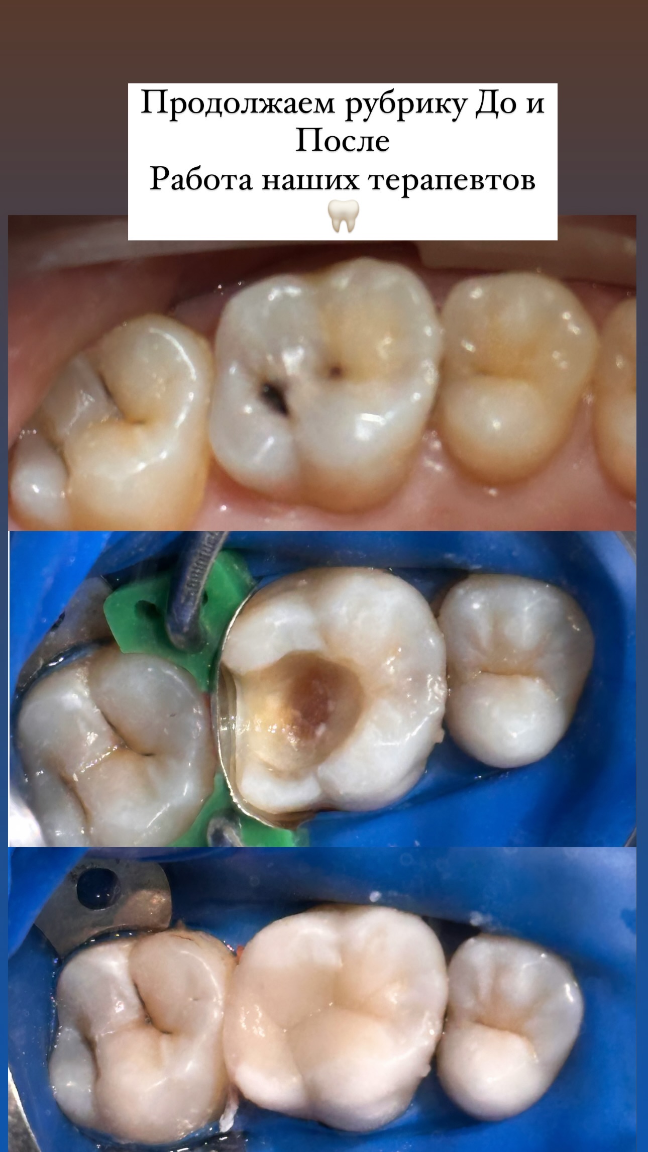 До и после лечения