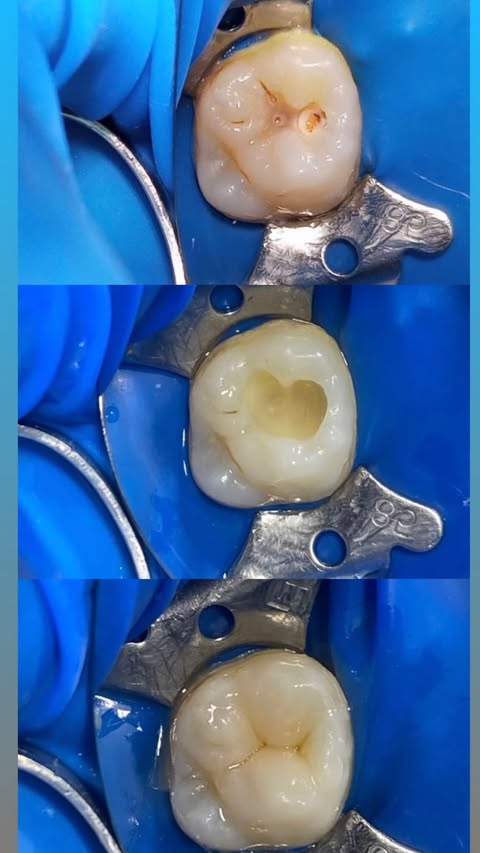 До и после терапии