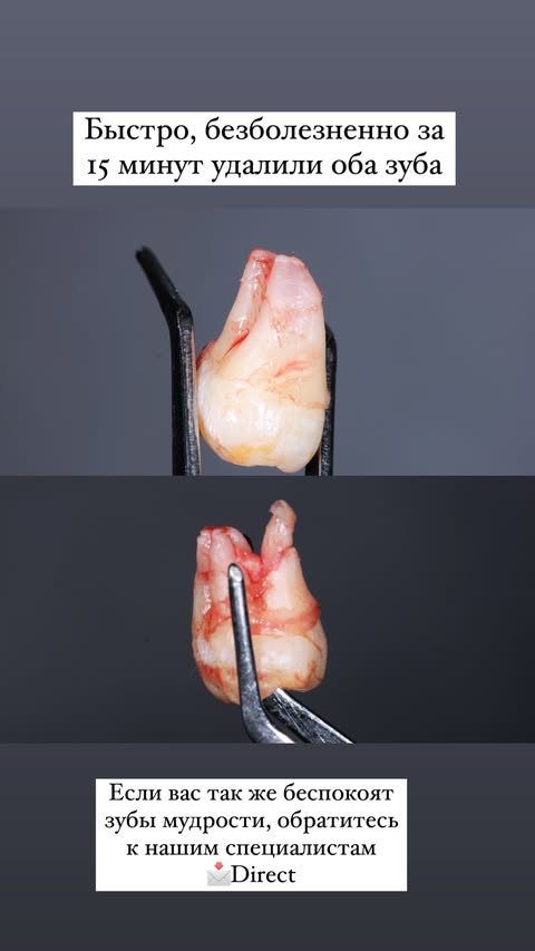 До и после — случай 3