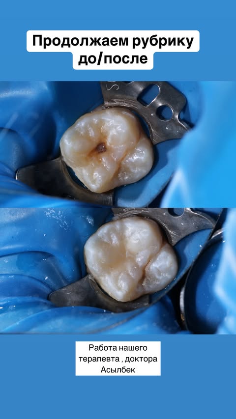 До и после — случай 4