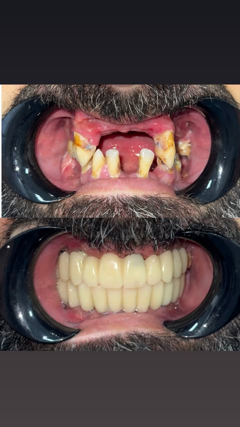 All on 4 — до и после