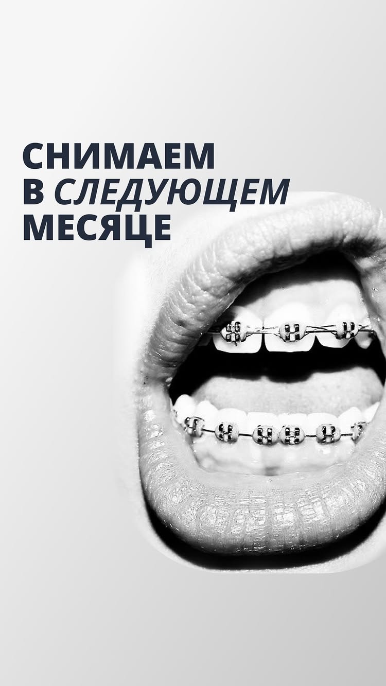 Ортодонтическое лечение